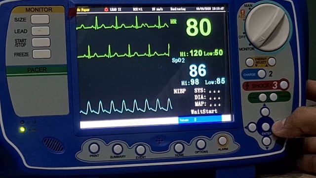 Defibrillator-Monitor VM 8000 смотреть онлайн