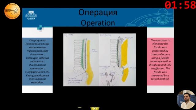 Свищ в конце тоннеля смотреть онлайн