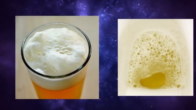 මුත්රා වල පෙණ එනවද | Protein in urine ( Sinhala clear explanation) смотреть онлайн