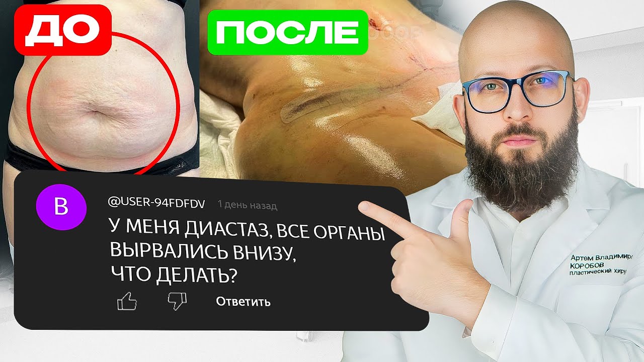 ВОПРОСЫ, КОТОРЫЕ ВЫ БОЯЛИСЬ СПРОСИТЬ про пластику (ответы на вопросы подписчиков) смотреть онлайн