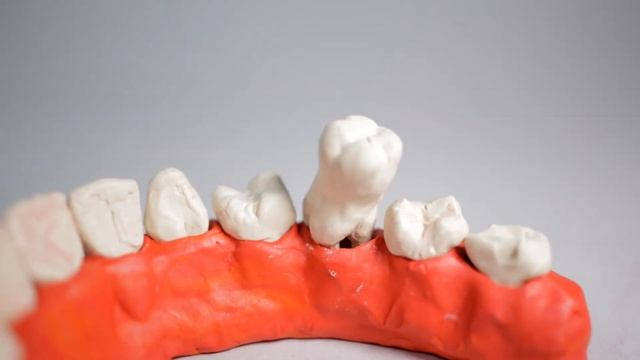 Модус-Центр. Пародонтология. (Modus Centre. Parodontics) 20 Sec.