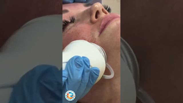 🔎 RF-лифтинг в МЦ Фамилия смотреть онлайн