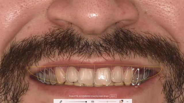 Цифровой дизайн улыбки смотреть онлайн