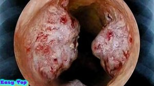 10 САМЫХ СТРАШНЫХ ЗАБОЛЕВАНИЙ В МИРЕ