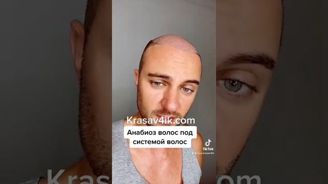 Анабиоз волос под системой. Убивает ли система волосы? #системаволос #красавчик #krasav4ik смотреть онлайн