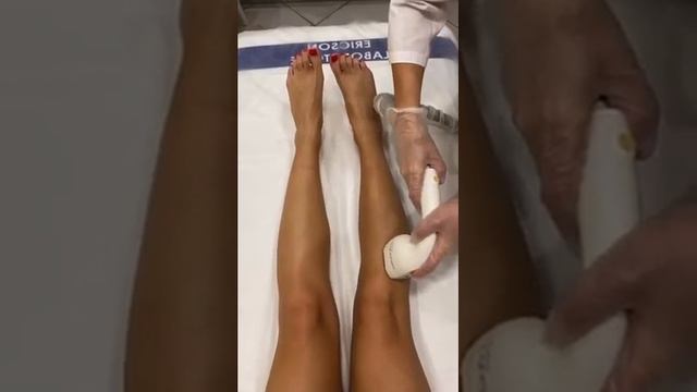 Лазерная эпиляция со скидкой до 60% в 