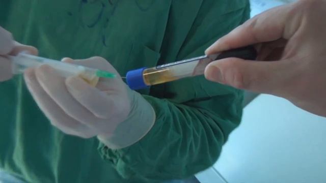 RegenLab. Процедура на связке надколенника.