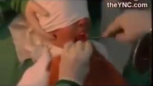 Удаление гланд . Для всех желающих вернуться в СССР.