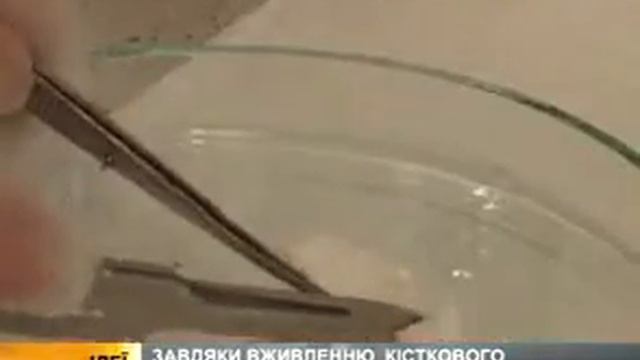 Поляки изобрели искусственные кости смотреть онлайн