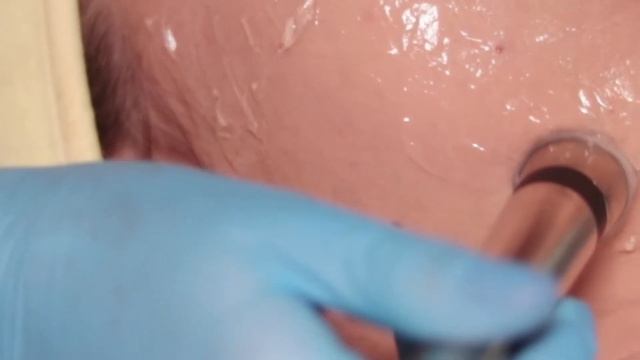 Аппаратная косметология в салоне красоты INjoy