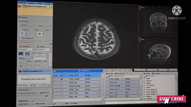 How to do MRI BRAIN in simple way 1.5 TESLA PHILIPS machine смотреть онлайн