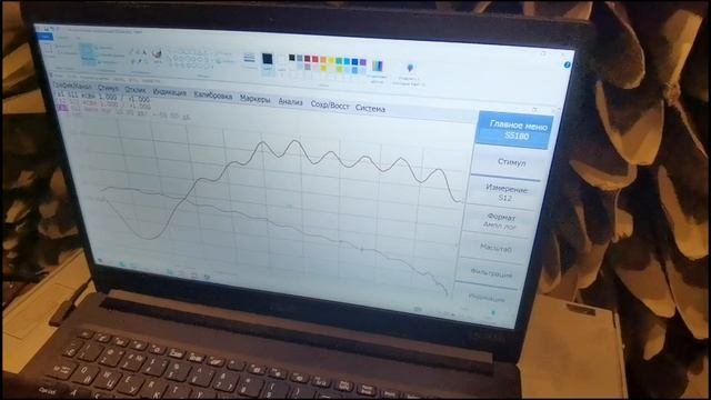 Купил нерабочую антенну для дачи на авито и попал на деньги смотреть онлайн