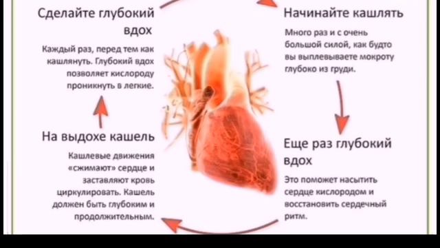 Что делать при сердечном приступе? смотреть онлайн