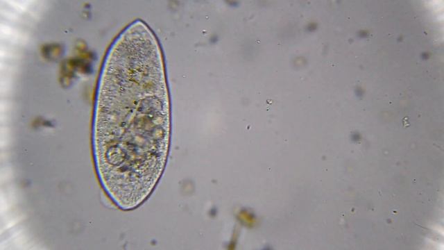 Последний танец Инфузории | Одноклеточный организм умирает смотреть онлайн