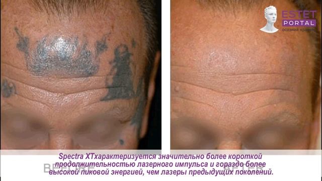 Лазерное оборудование как эффективная бизнес модель для клиники смотреть онлайн