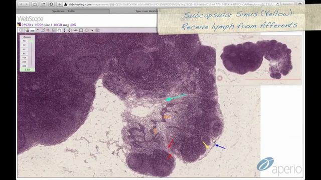 Дифференциальная диагностика лимфоидных органов. Гистологическое строение. Норма. смотреть онлайн