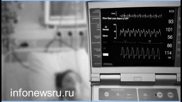 Верхнее и нижнее давление у человека, что это значит? смотреть онлайн