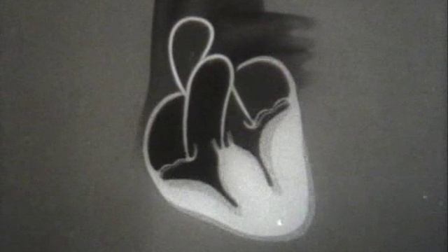 Физиология человека. Значение тренировки сердца