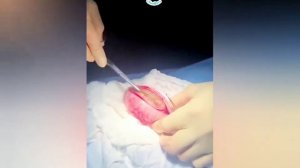 ОГРОМНЫЙ комок шерсти, извлеченный из желудка кошки