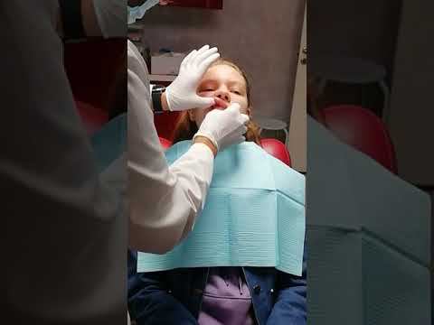 После снятия брекет системы - ортодонт Дьяченко Виталий Владимирович / Стоматология Эстетикс, Москва смотреть онлайн