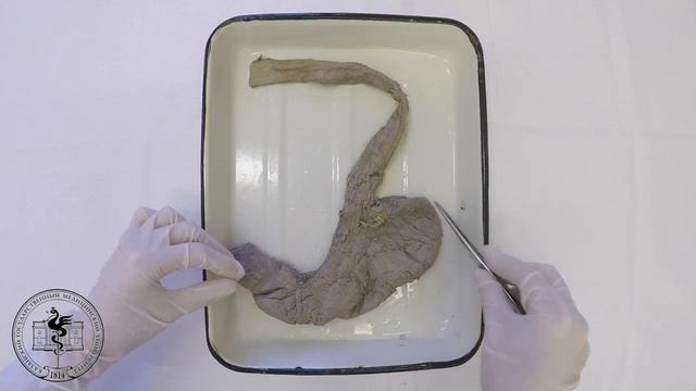 Спланхнология, анатомия желудка смотреть онлайн