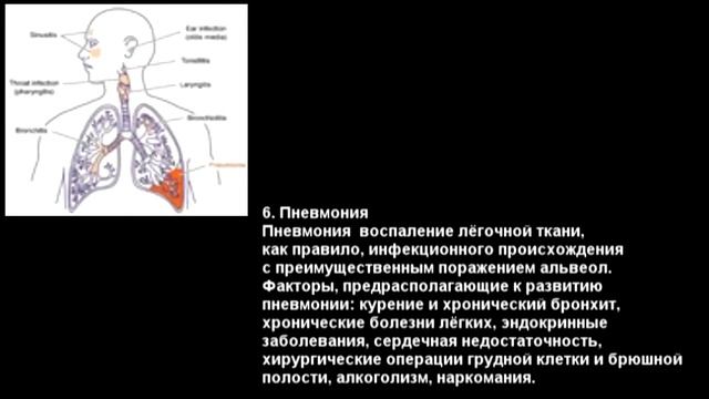 Топ 10 опасных болезней мира! смотреть онлайн