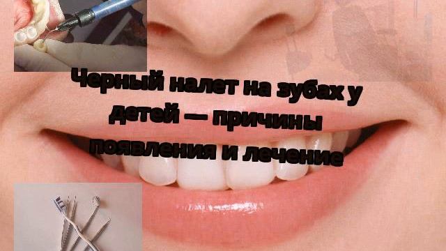 Черный налет на зубах у детей — причины появления и лечение смотреть онлайн