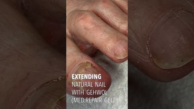 Медицинский педикюр. Используется продукция от немецкой компании Gehwol. смотреть онлайн