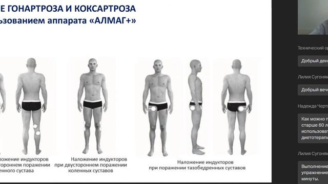 Магнитотерапия. Видеолекция РМАПО смотреть онлайн