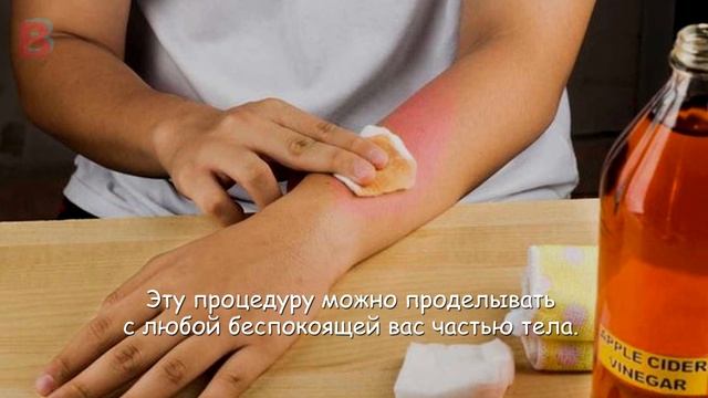 ТРИ ОСНОВНЫХ РЕЦЕПТА с Яблочным уксусом для лечения БОЛИ (артрита) в Суставах смотреть онлайн
