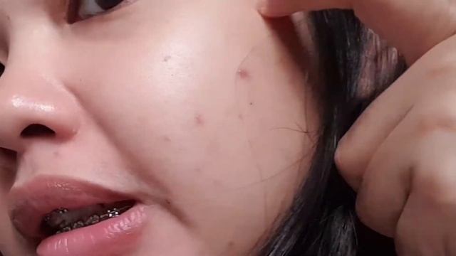La Roche-Posay EFFACLAR Medicated Gel Cleanser for Acne Prone Skin Experience | Philippines смотреть онлайн