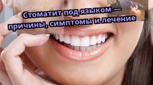 Стоматит под языком — причины, симптомы и лечение