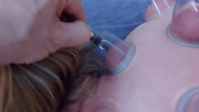 сухая хиджама смотреть онлайн