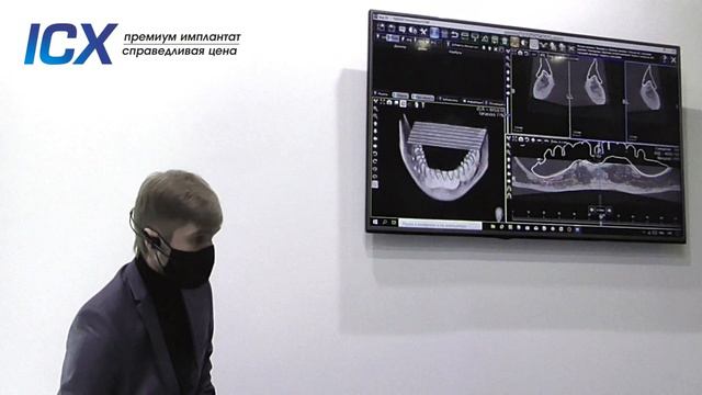 Цифровой протокол в имплантологии: взгляд ортопеда. Владимир Микрюков, ICX Russia смотреть онлайн