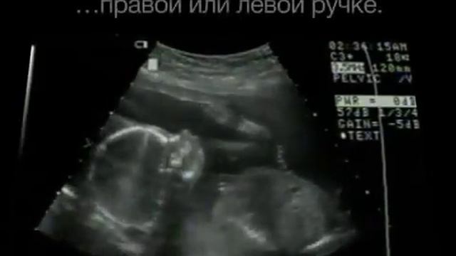 ЧУДО ЖИЗНИ !!! (социальный видеоролик лучшее из того что видел) смотреть онлайн