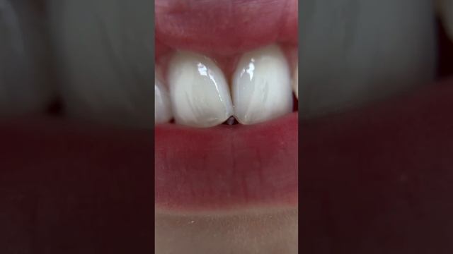 Макролинза (MACRO GO 25x) для телефона (IPhone, Android) , арт: 53289196 #wildberries #обзор смотреть онлайн