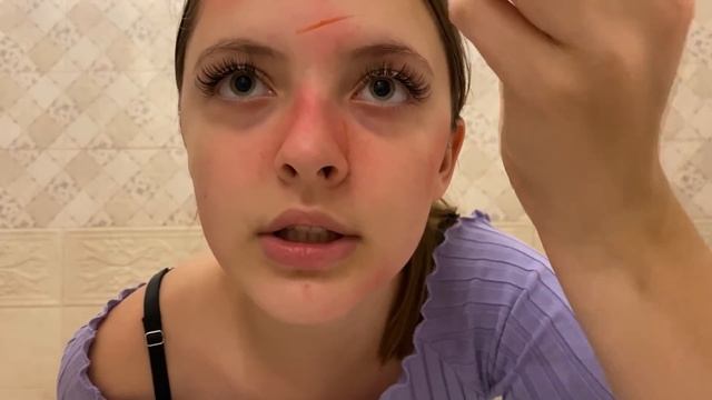 ПРАНК НАД МАМОЙ.СТРАШНАЯ АЛЛЕРГИЯ*103*едем в больницу смотреть онлайн