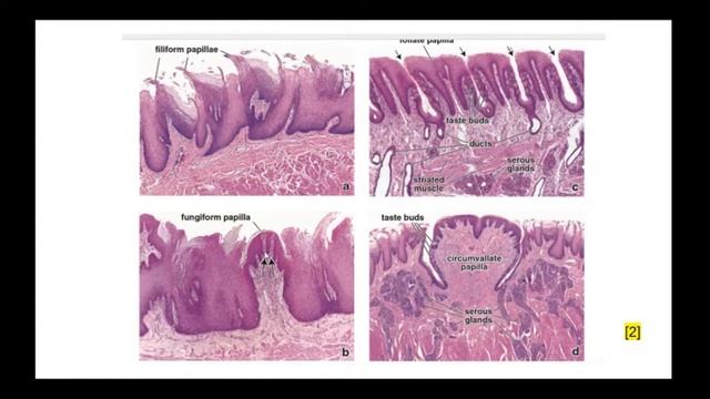 Препараты: листовидные, нитевидные сосочки языка.Типы сосочков языка. Строение вкусовой луковицы. смотреть онлайн