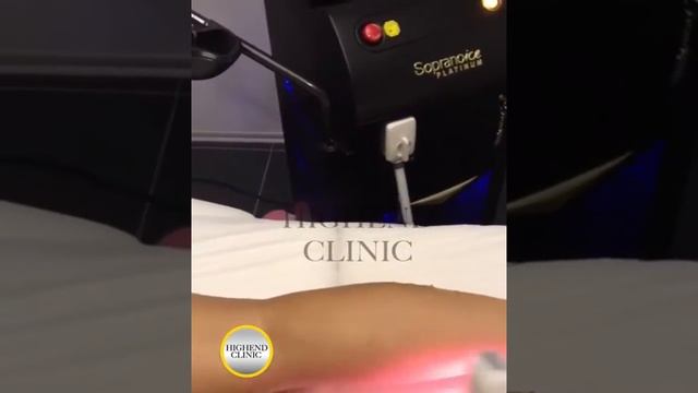 Highend Clinic - Soprano Ice Buz Lazer Epilasyon смотреть онлайн