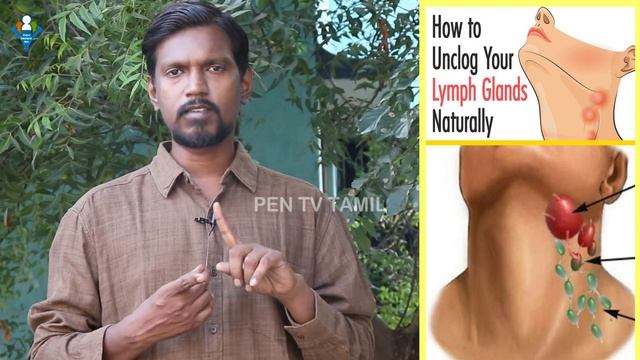 தோலுக்குக் கீழ் உள்ள நிணநீர்ச் சுரப்பிகள் வீங்கினால்...|Swollen Lymph Glands #health Dr.M.Kalaivana смотреть онлайн