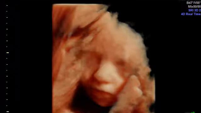 27 недель 3 дня смотреть онлайн