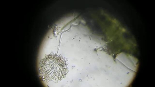 Colonial ciliate | Колониальные инфузории (сувойки) Epistylis plicatilis (Ciliata, Protozoa) смотреть онлайн