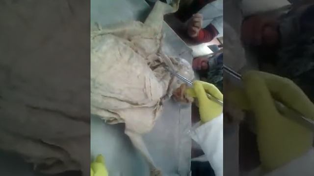 М'язи хребетного стовпа смотреть онлайн