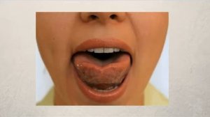 Артикуляционное упражнение Чашечка для языка. Артикуляционная гимнастика упражнение Чашечка