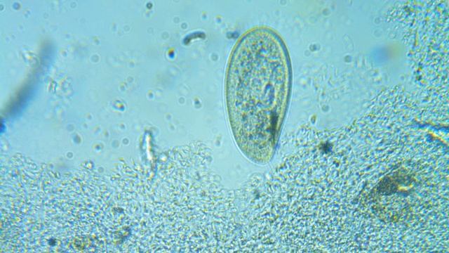 Инфузория туфелька двигается смотреть онлайн
