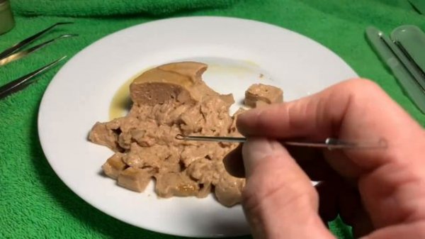 Черви в печени трески,найду ли_ Смотреть до конца _ Worms in the liver of cod, will I find them_