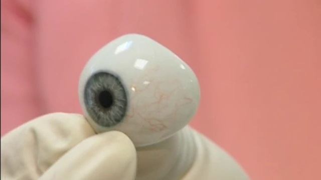 Какой протез выбрать стеклянный или пластмассовый смотреть онлайн