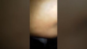 Установка электрики фаркоп дачия логан мсв