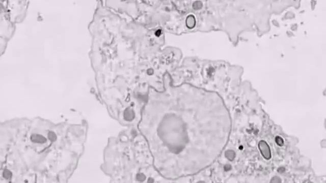 Ancient live largest virus Древний живой самый большой вирус Pithovirus sibericum смотреть онлайн