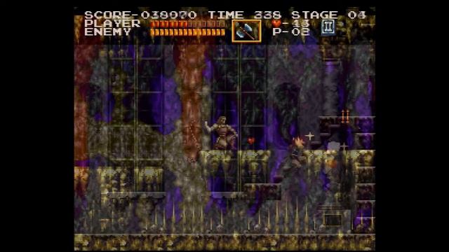 Castlevania Chronicles Review for the Sony PlayStation смотреть онлайн